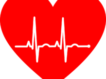 ekg, electrocardiogram, heart-2069872.jpg